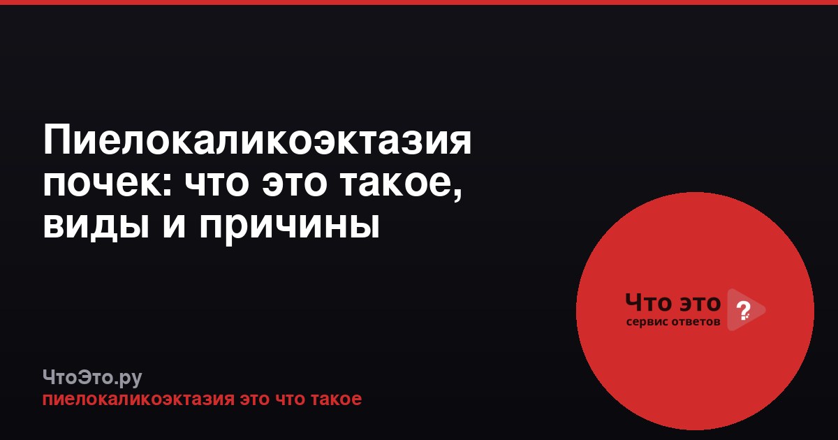 Пиелокаликоэктазия почек: что это такое, виды и причины