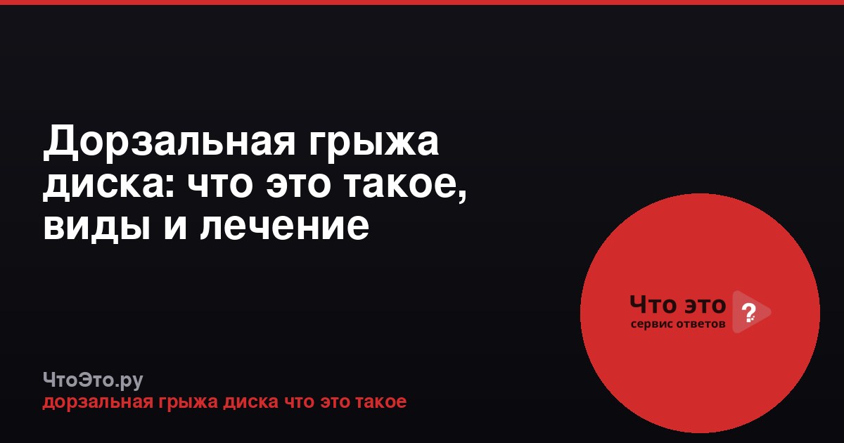 Дорзальная грыжа диска: что это такое, виды и лечение