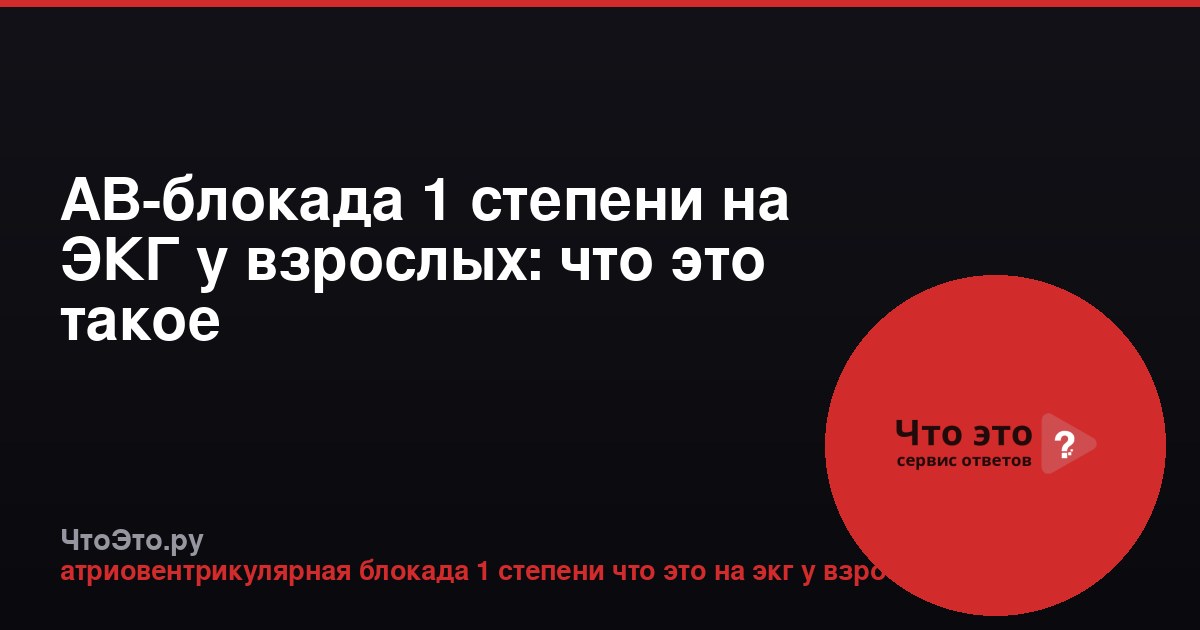 АВ-блокада 1 степени на ЭКГ у взрослых: что это такое
