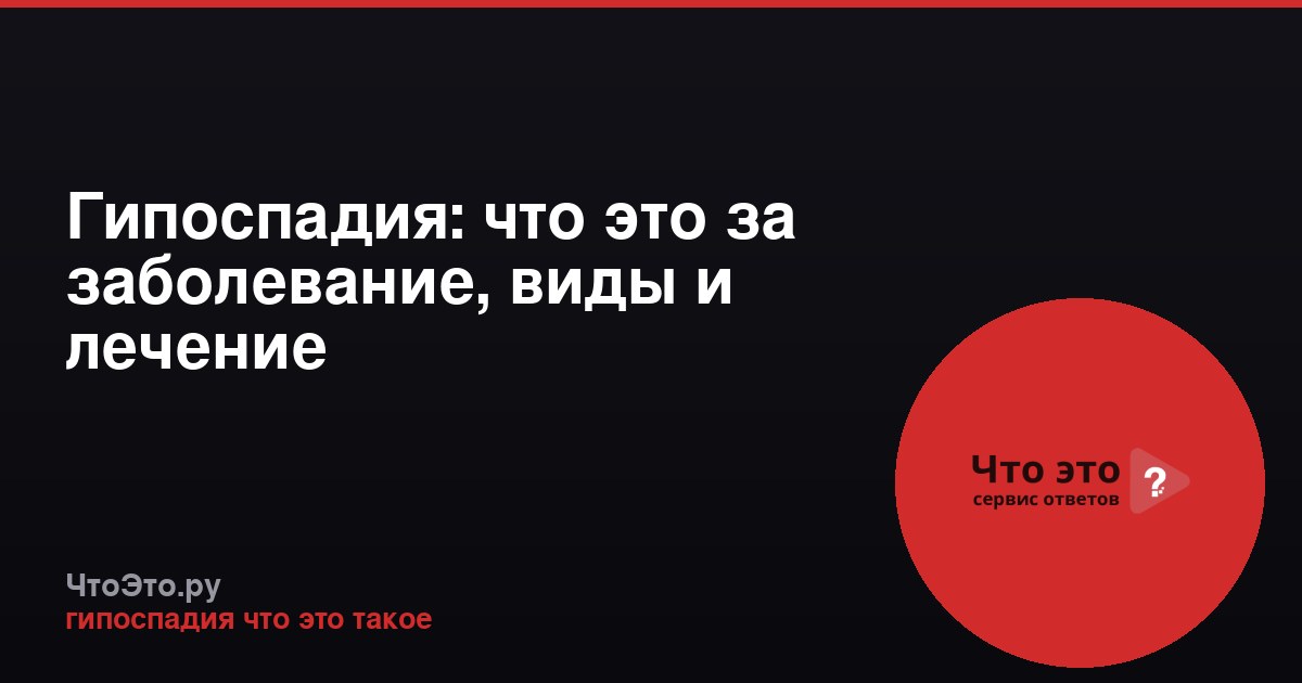 Гипоспадия: что это за заболевание, виды и лечение