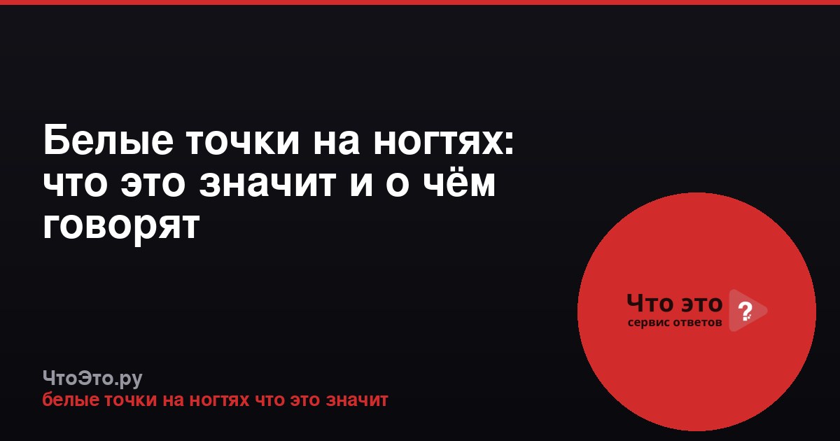 Белые точки на ногтях: что это значит и о чём говорят
