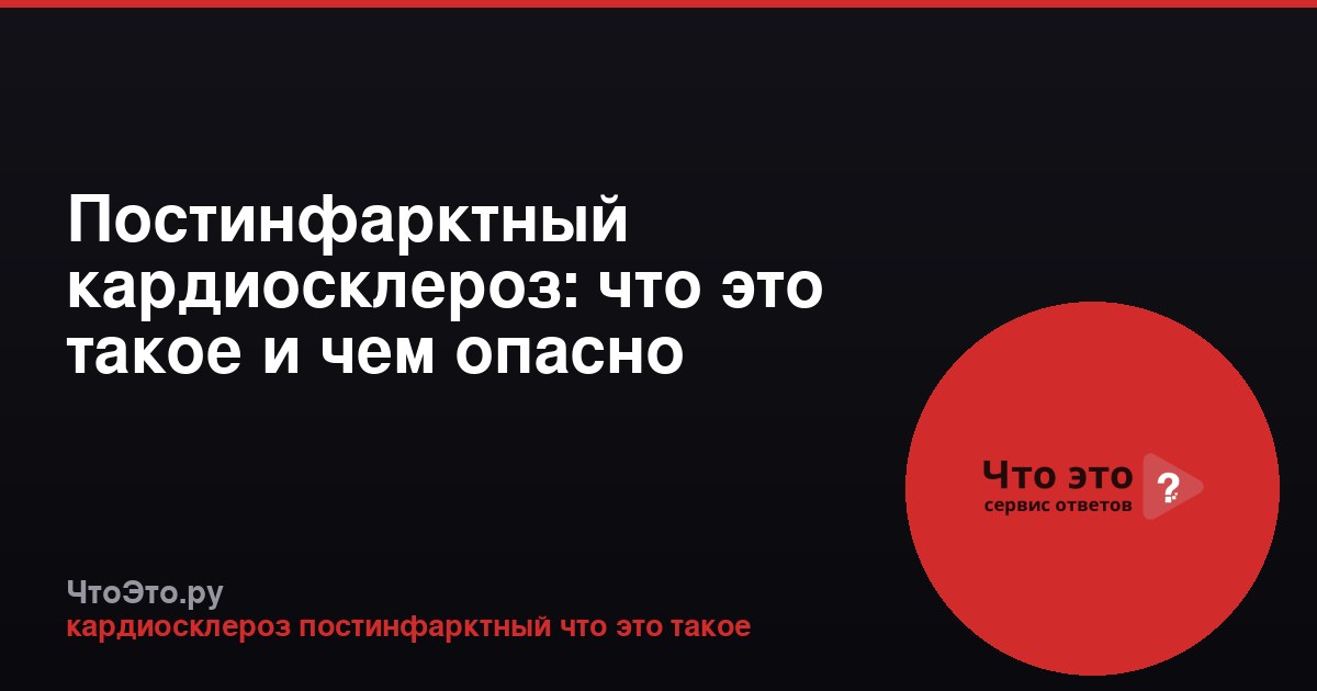 Постинфарктный кардиосклероз: что это такое и чем опасно