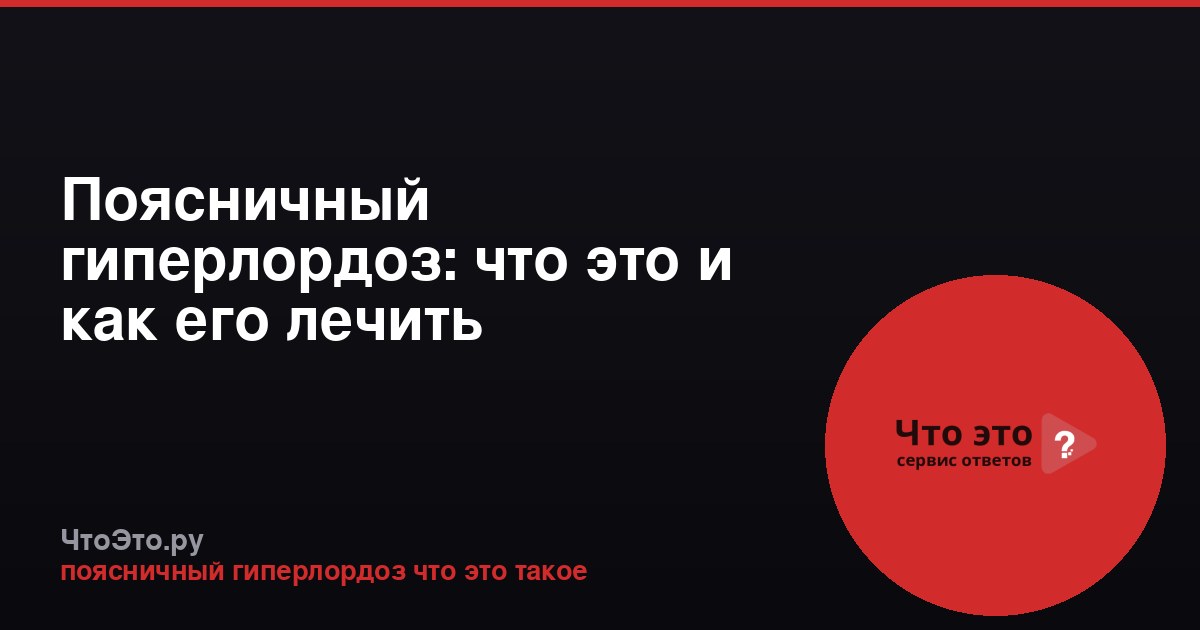 Поясничный гиперлордоз: что это и как его лечить