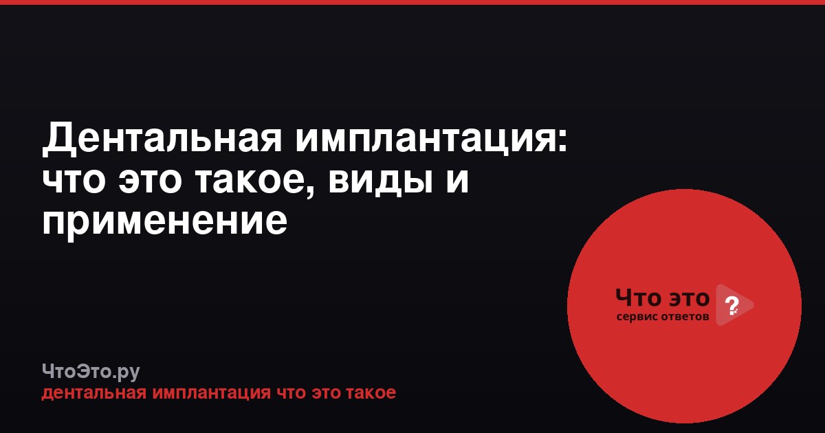 Дентальная имплантация: что это такое, виды и применение
