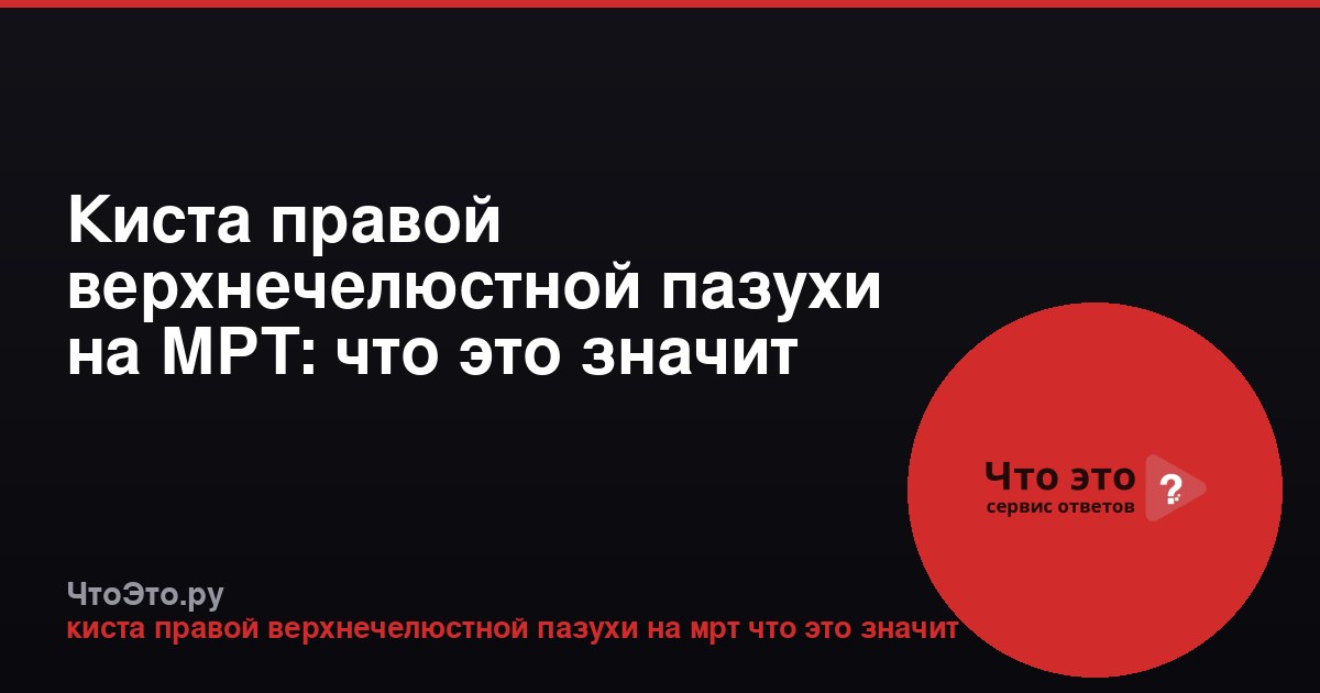 Киста правой верхнечелюстной пазухи на МРТ: что это значит