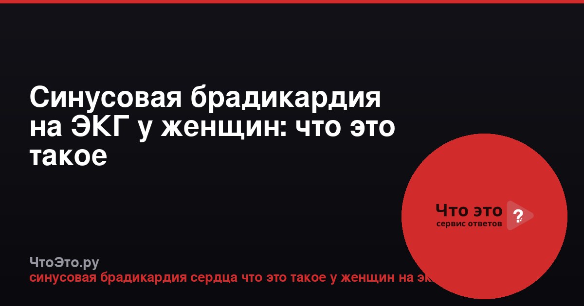 Синусовая брадикардия на ЭКГ у женщин: что это такое