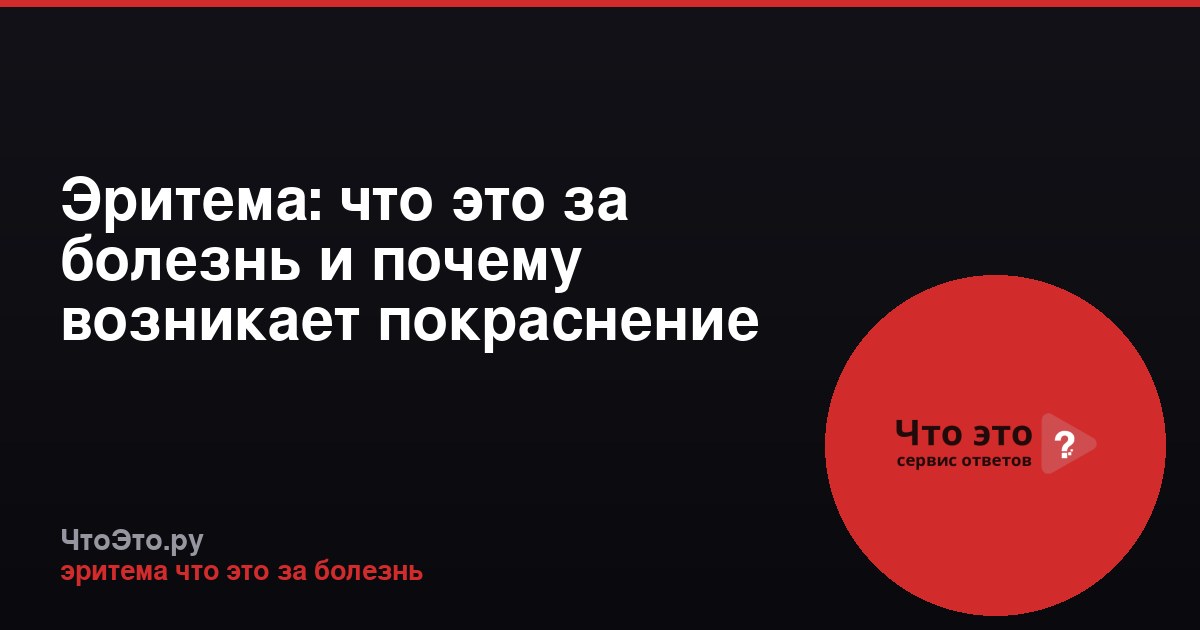 Эритема: что это за болезнь и почему возникает покраснение кожи