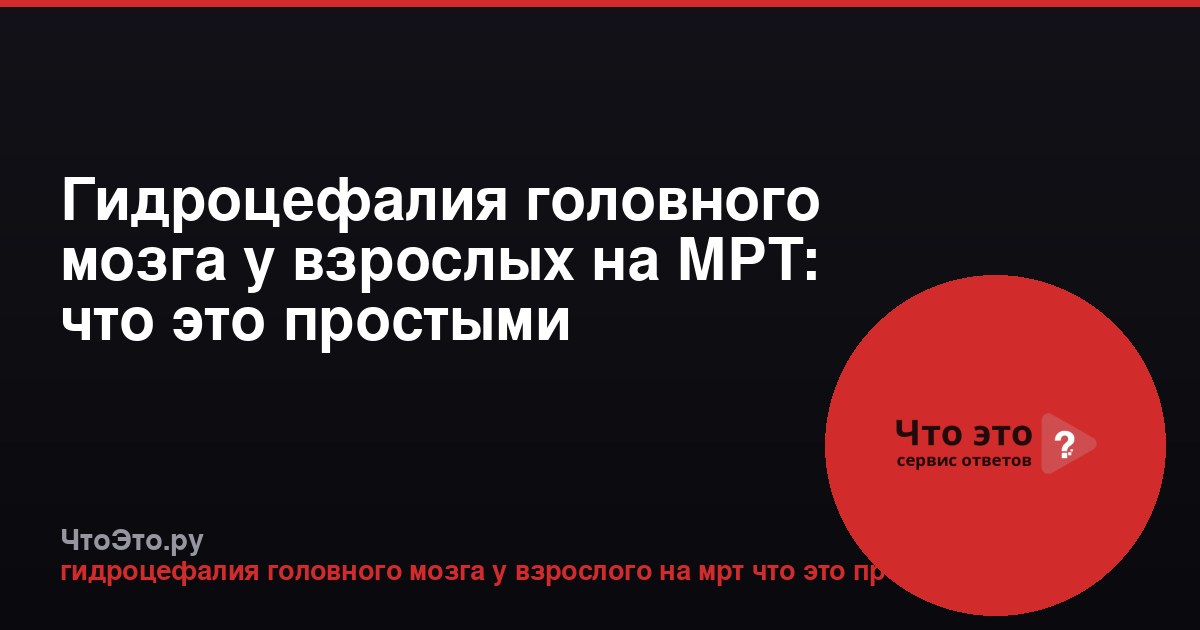 Гидроцефалия головного мозга у взрослых на МРТ: что это простыми словами