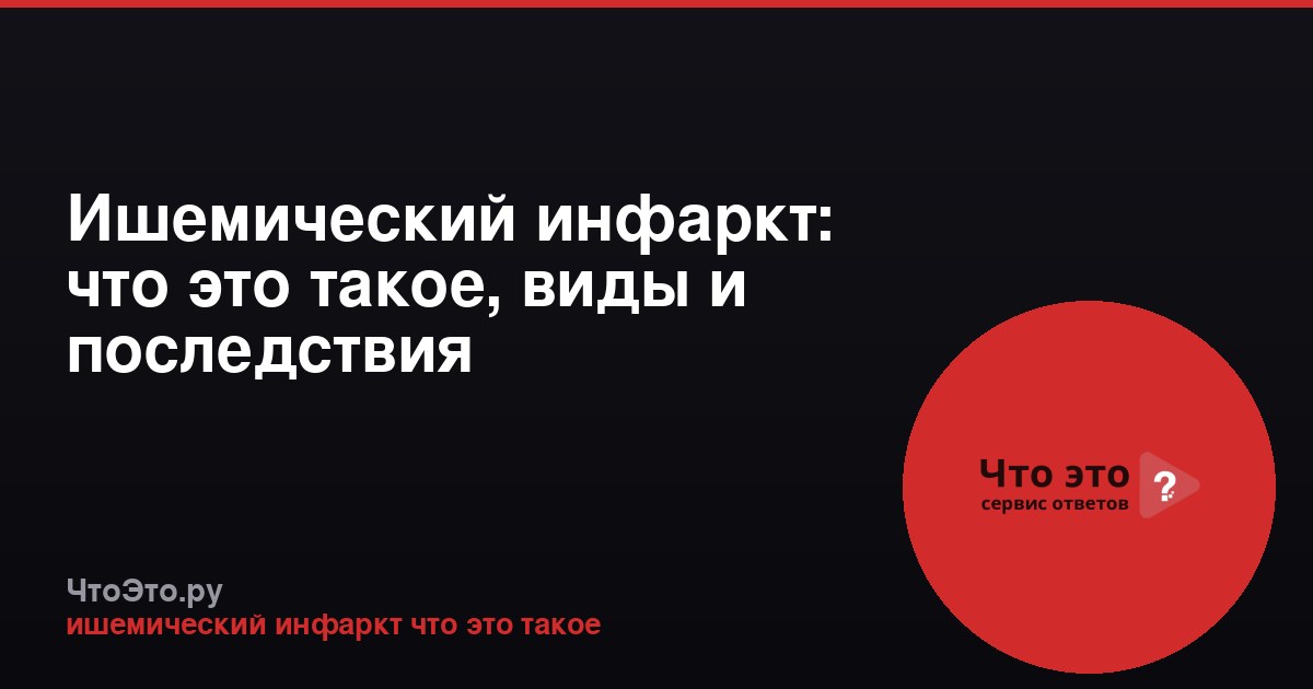 Ишемический инфаркт: что это такое, виды и последствия