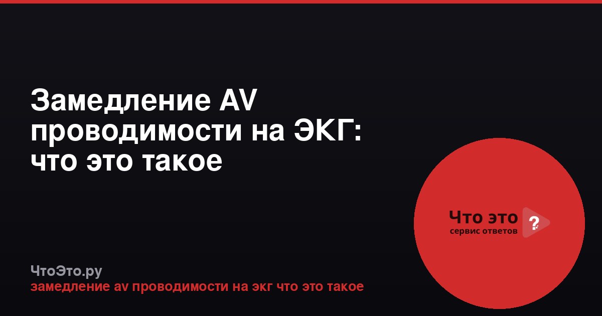 Замедление AV проводимости на ЭКГ: что это такое