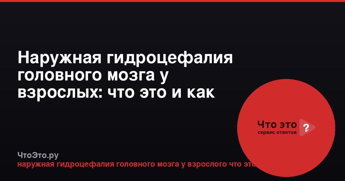 Наружная гидроцефалия головного мозга у взрослых: что это и как лечить