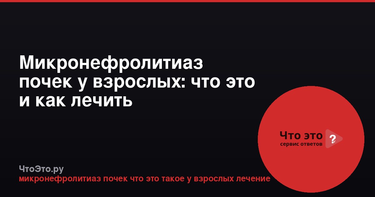 Микронефролитиаз почек у взрослых: что это и как лечить