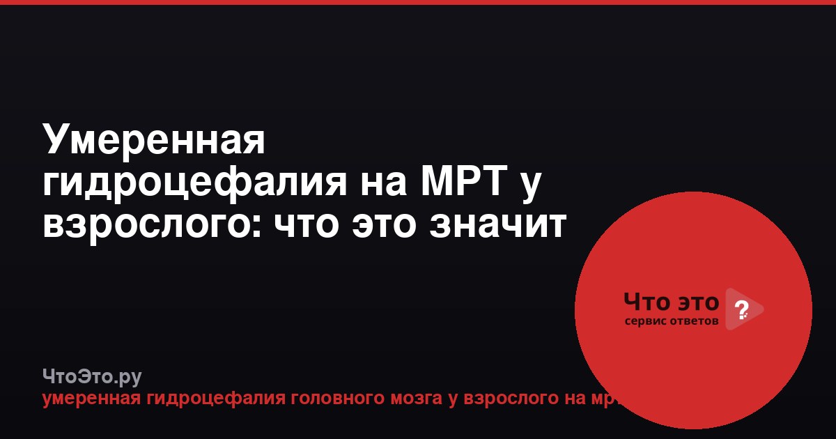 Умеренная гидроцефалия на МРТ у взрослого: что это значит