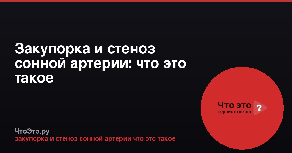 Закупорка и стеноз сонной артерии: что это такое