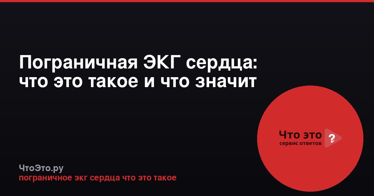 Пограничная ЭКГ сердца: что это такое и что значит