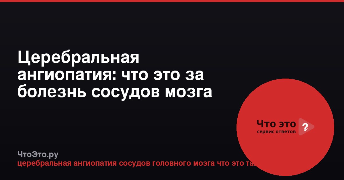 Церебральная ангиопатия: что это за болезнь сосудов мозга