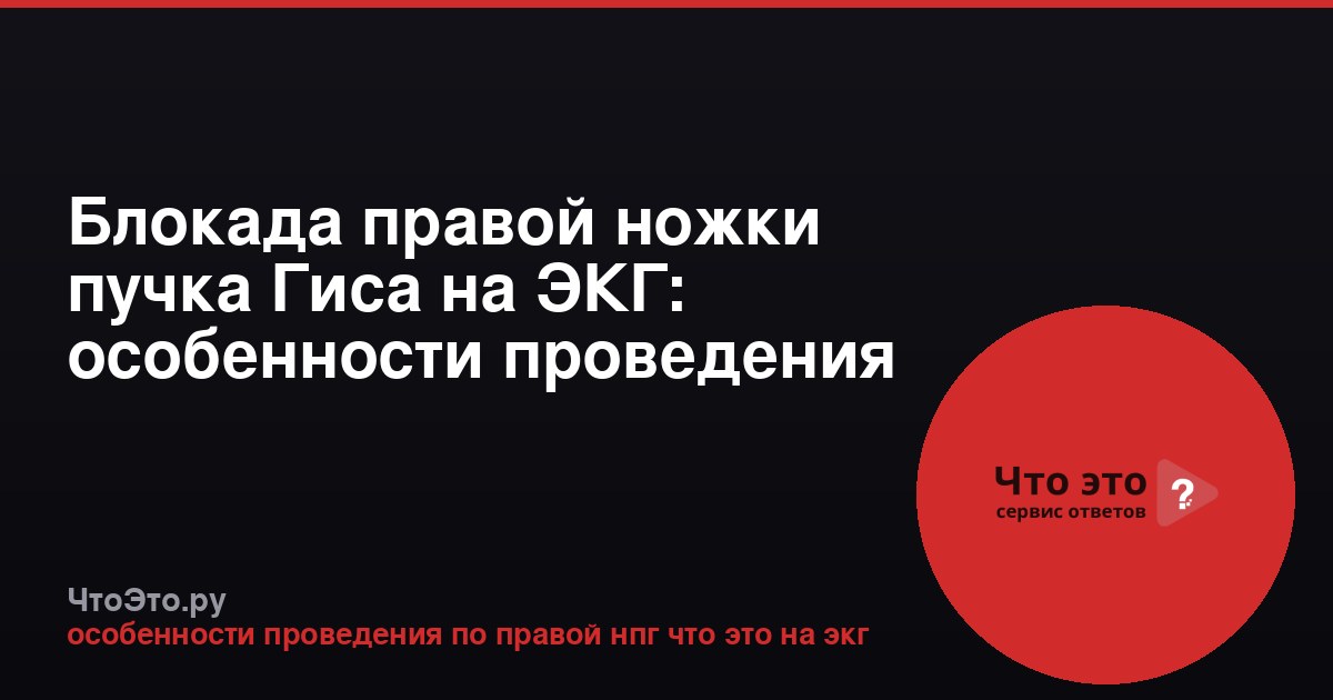 Блокада правой ножки пучка Гиса на ЭКГ: особенности проведения
