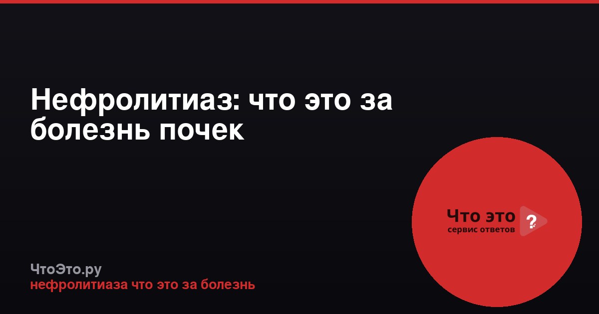 Нефролитиаз: что это за болезнь почек