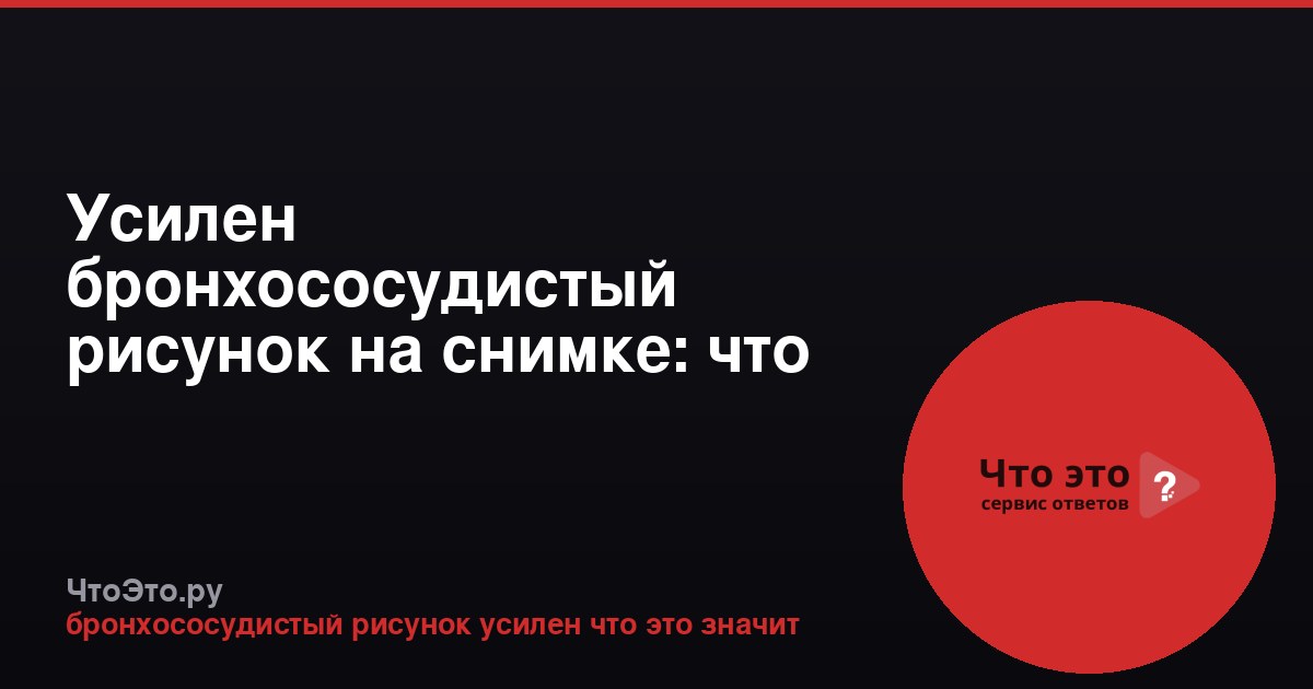 Усилен бронхососудистый рисунок на снимке: что это значит?