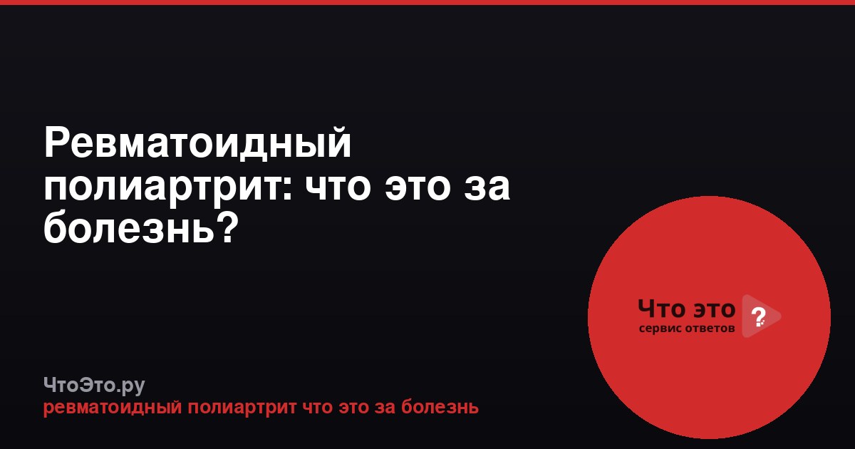 Ревматоидный полиартрит: что это за болезнь?