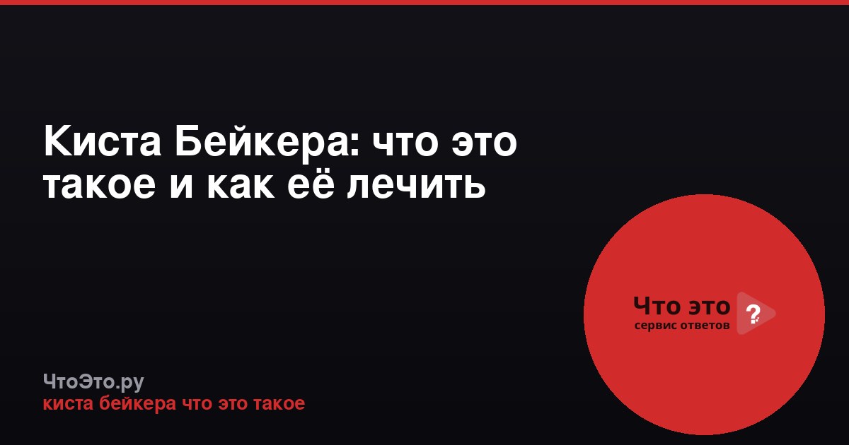 Киста Бейкера: что это такое и как её лечить