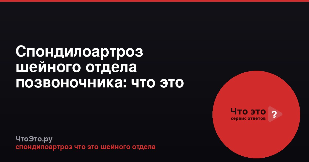 Спондилоартроз шейного отдела позвоночника: что это такое