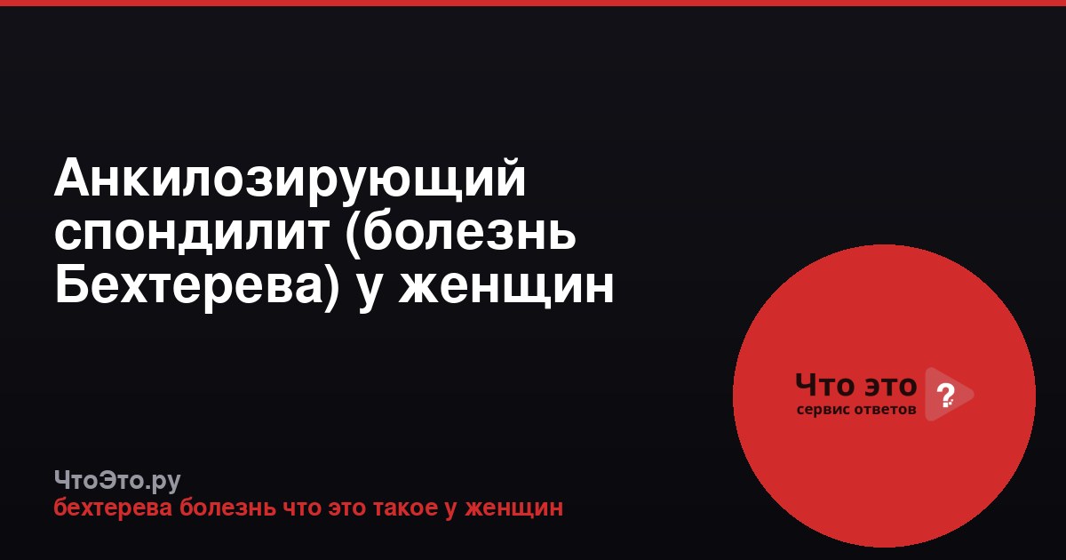 Анкилозирующий спондилит (болезнь Бехтерева) у женщин