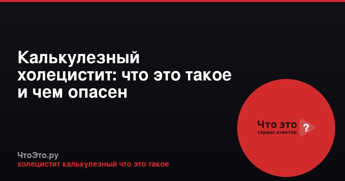 Калькулезный холецистит: что это такое и чем опасен