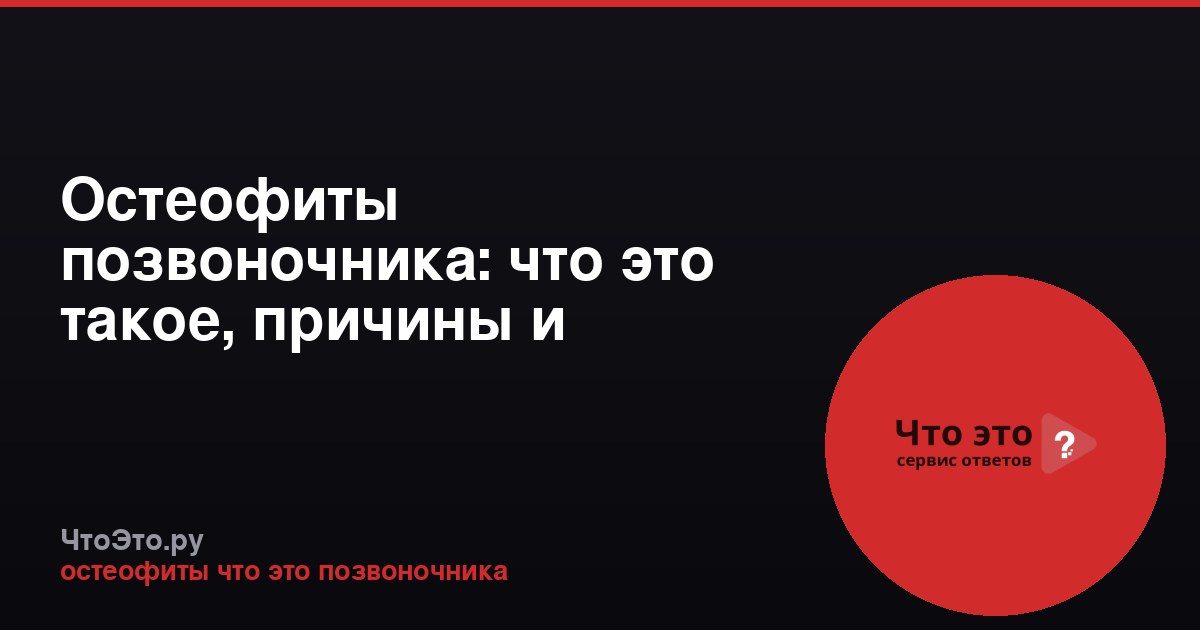 Остеофиты позвоночника: что это такое, причины и симптомы