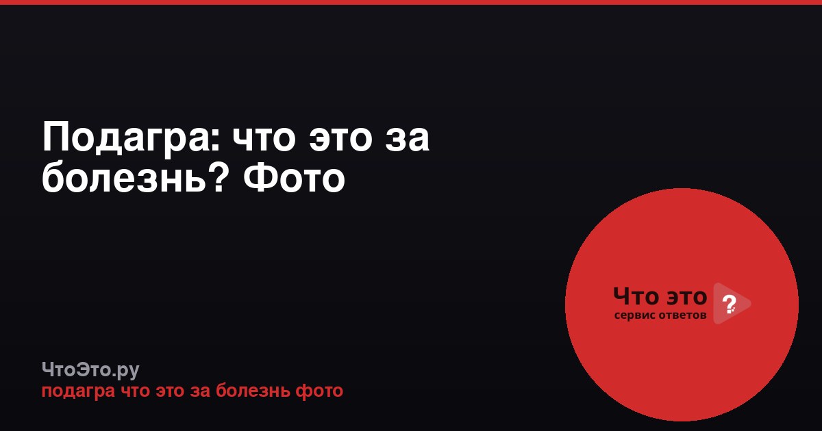 Подагра: что это за болезнь? Фото