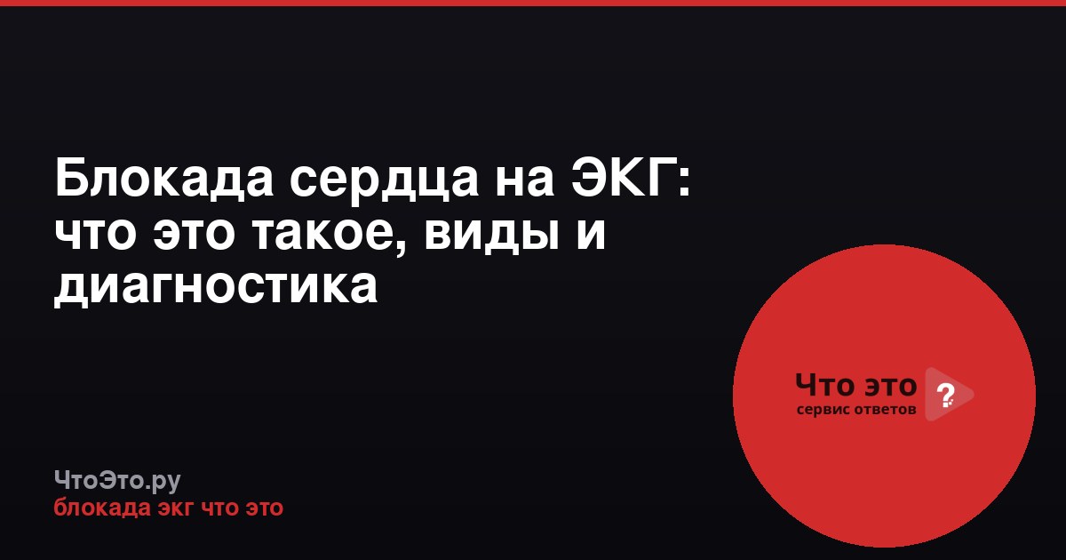 Блокада сердца на ЭКГ: что это такое, виды и диагностика