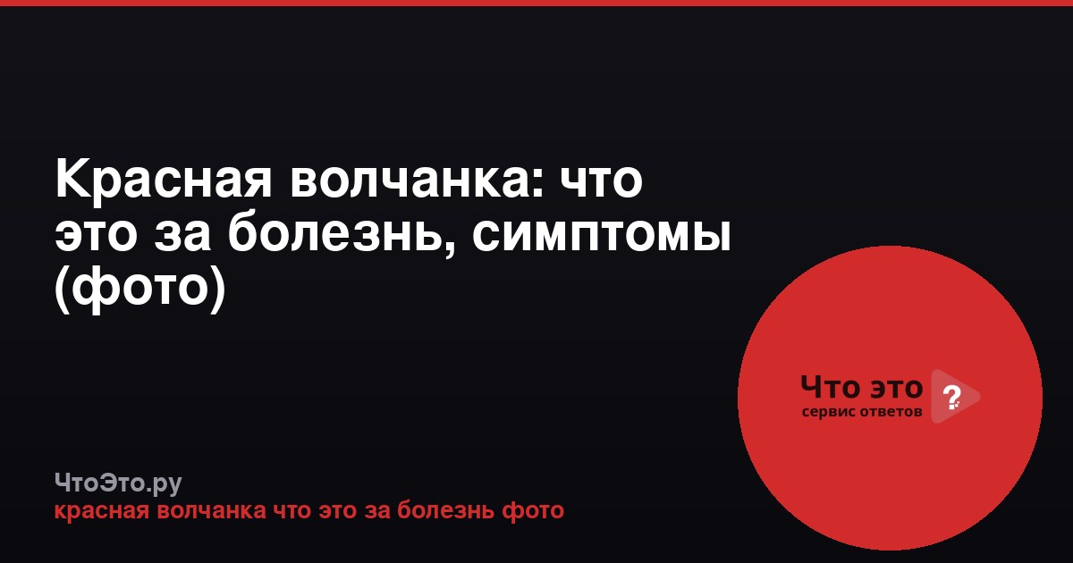 Красная волчанка: что это за болезнь, симптомы (фото)