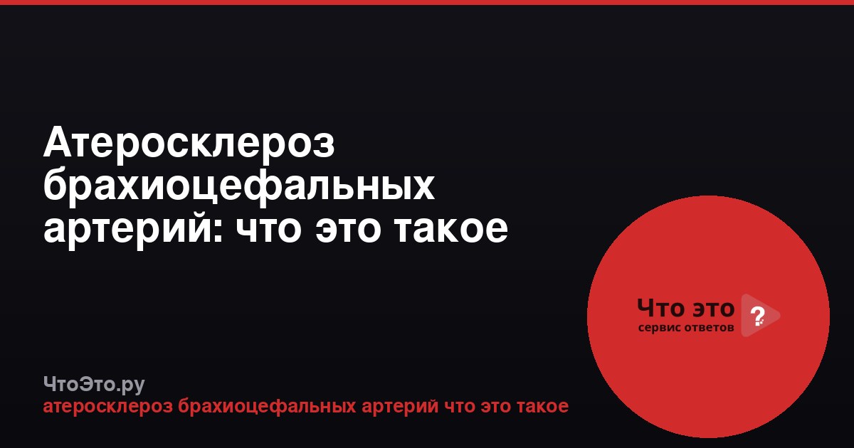 Атеросклероз брахиоцефальных артерий: что это такое