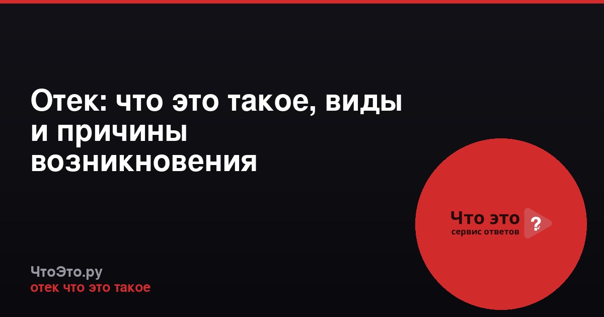 Отек: что это такое, виды и причины возникновения