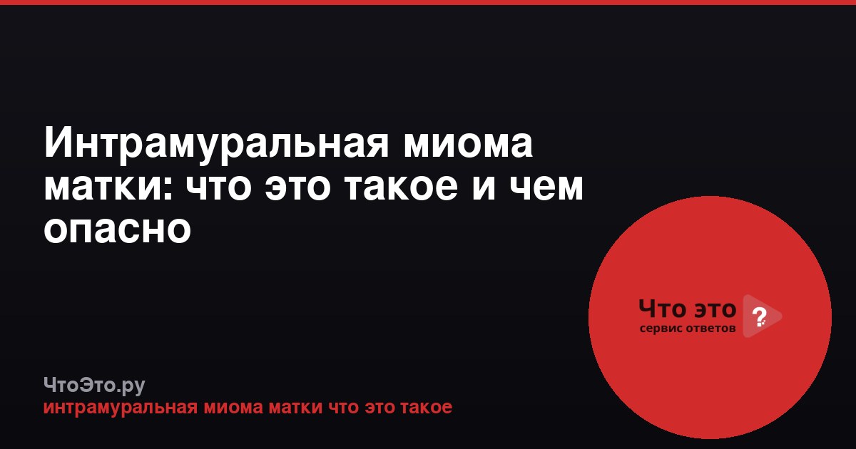 Интрамуральная миома матки: что это такое и чем опасно