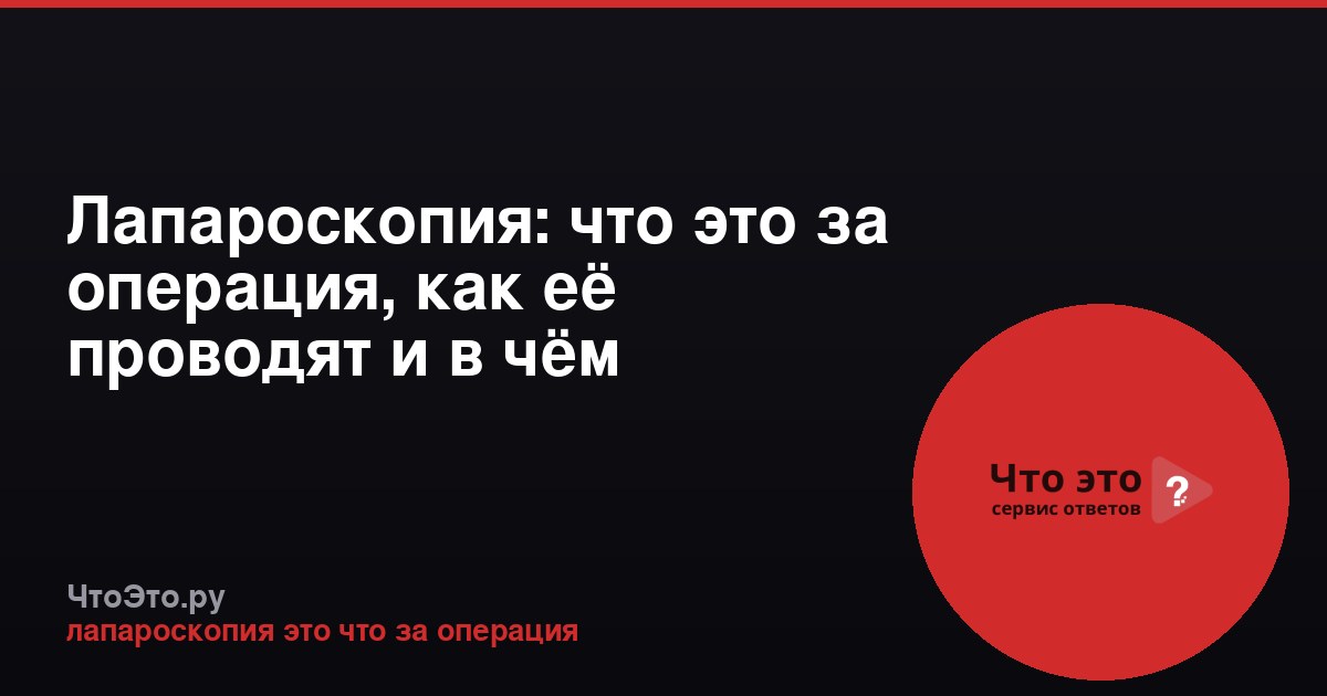 Лапароскопия: что это за операция, как её проводят и в чём преимущества