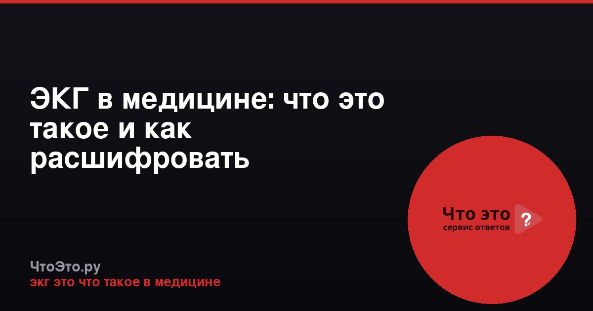 ЭКГ в медицине: что это такое и как расшифровать