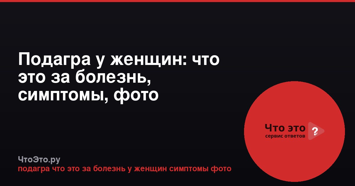 Подагра у женщин: что это за болезнь, симптомы, фото
