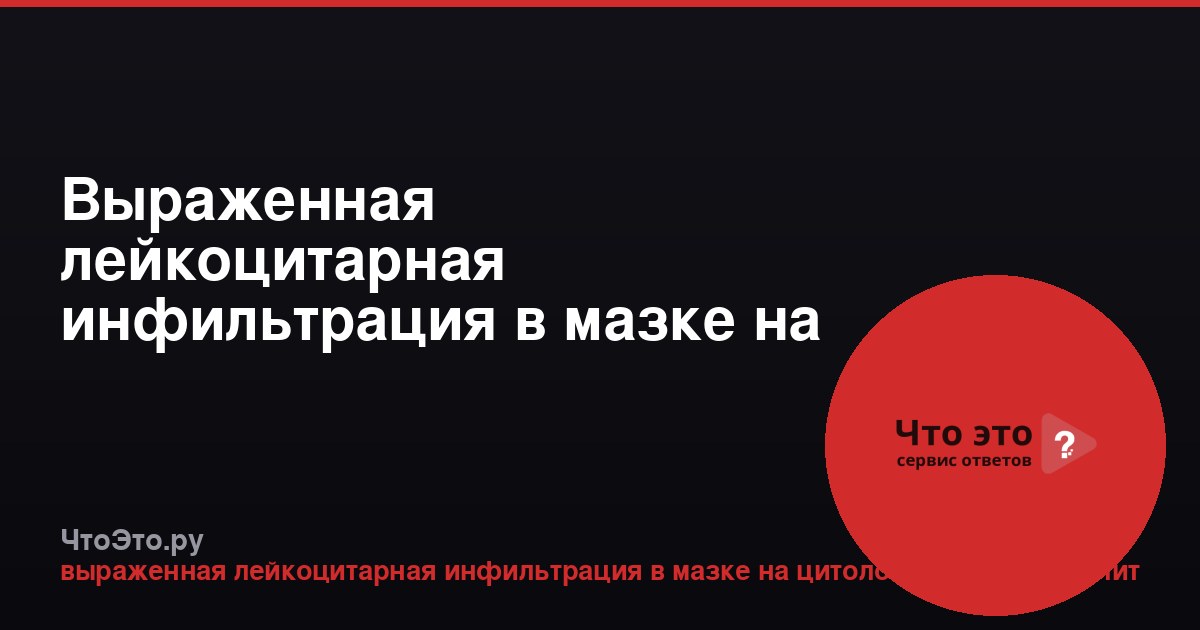 Выраженная лейкоцитарная инфильтрация в мазке на цитологию: что это значит