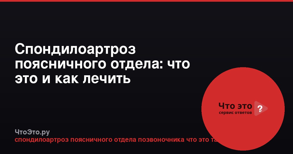 Спондилоартроз поясничного отдела: что это и как лечить