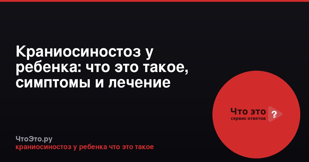 Краниосиностоз у ребенка: что это такое, симптомы и лечение