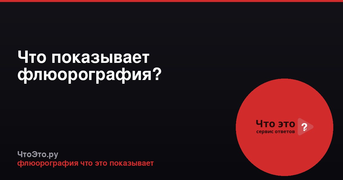 Что показывает флюорография?