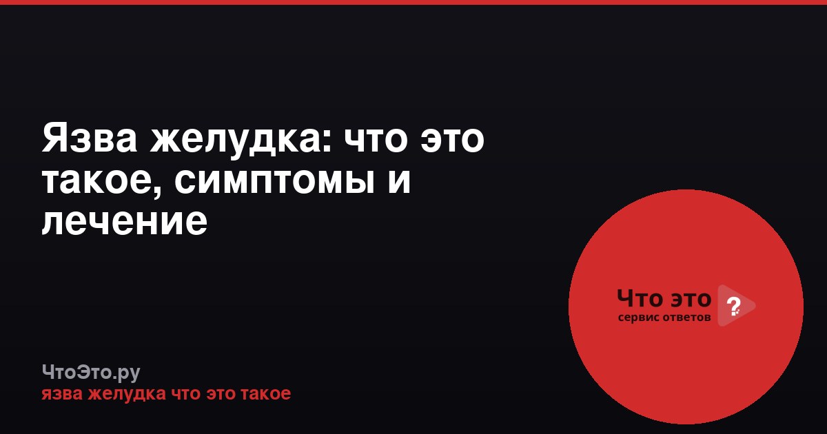 Язва желудка: что это такое, симптомы и лечение