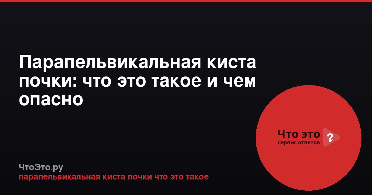 Парапельвикальная киста почки: что это такое и чем опасно