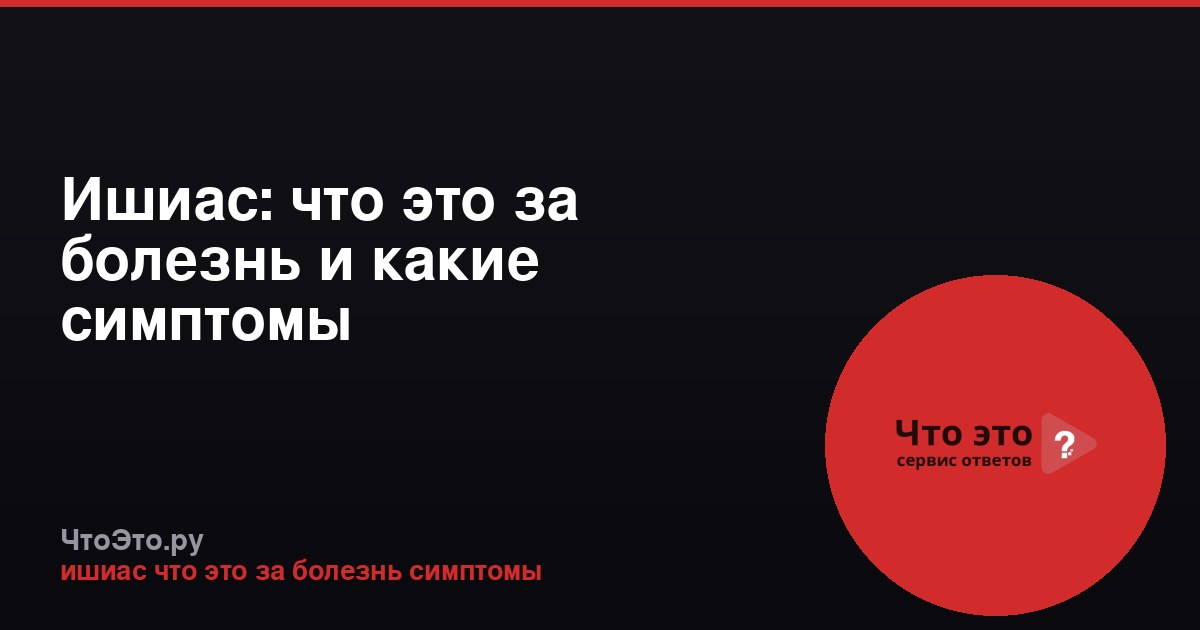 Ишиас: что это за болезнь и какие симптомы