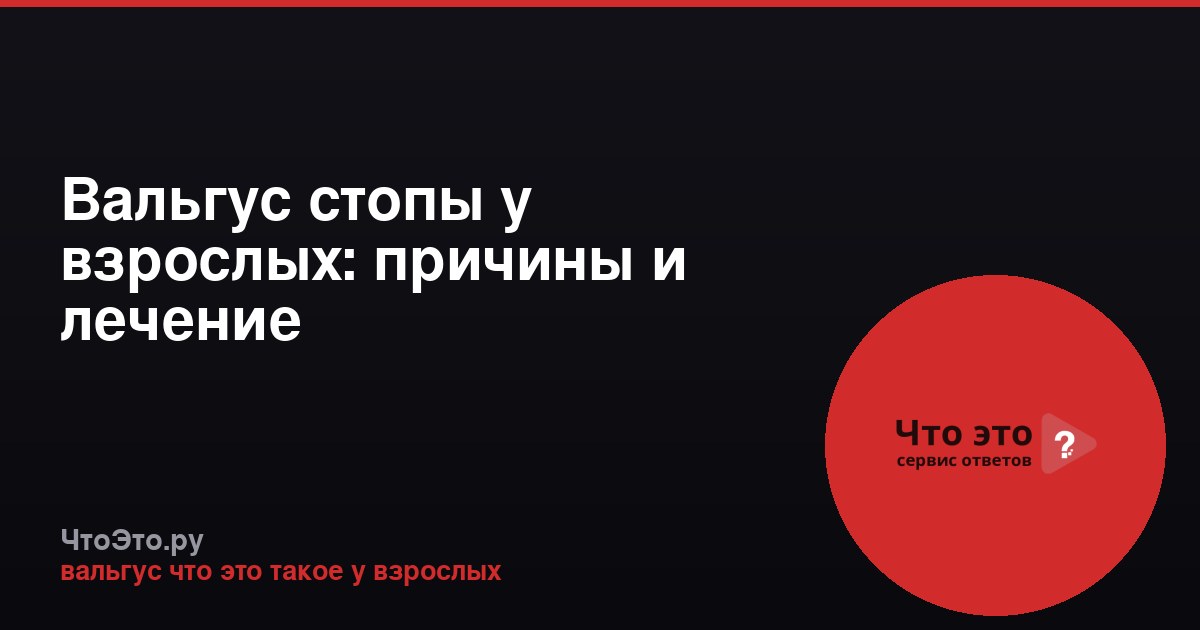 Вальгус стопы у взрослых: причины и лечение