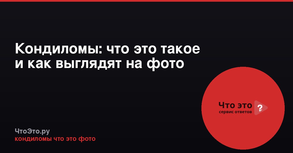 Кондиломы: что это такое и как выглядят на фото