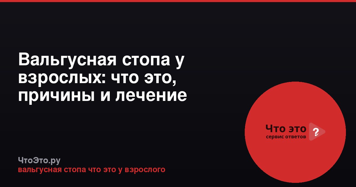 Вальгусная стопа у взрослых: что это, причины и лечение