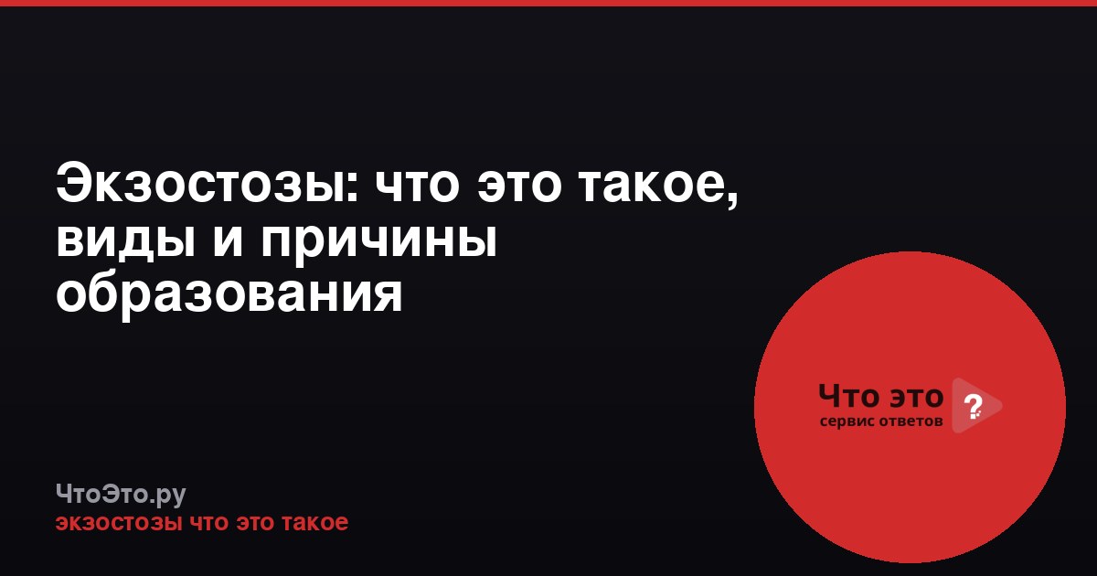 Экзостозы: что это такое, виды и причины образования