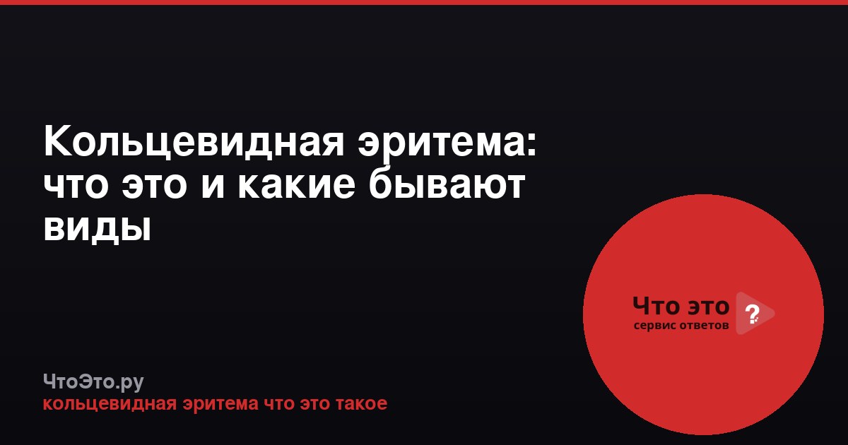 Кольцевидная эритема: что это и какие бывают виды